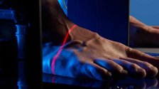 Foot Mapping & Gait Analysis